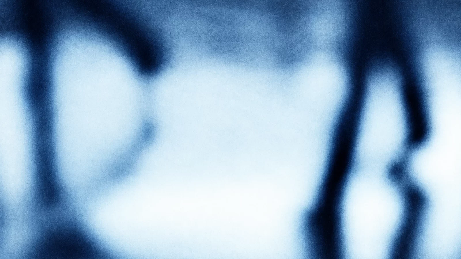 Shadows’ abstract blue, grainy photographic silhouettes.